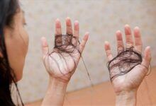 ¿Pueden los niveles elevados de estrés hacer que su cabello se caiga?