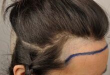 línea del pelo-lacaidadelpelo