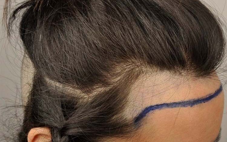 línea del pelo-lacaidadelpelo