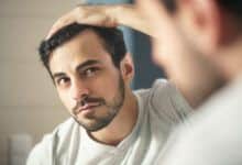 Tratamiento anticaída del cabello: Tagamet