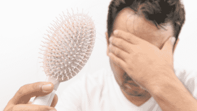 ¿El estrés provoca la caída del cabello?