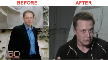 Restauración del cabello Elon Musk antes y después