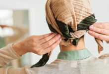 Cómo hacer frente a la pérdida de cabello por alopecia areata