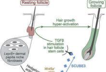 SCUBE3 molécula de señalización para el crecimiento del cabello